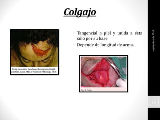 Colgajo
• Tangencial a piel y unida a ésta
sólo por su base
• Depende de longitud de arma.
septiembrede2015
56
 