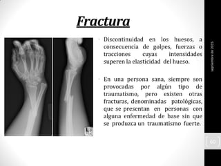 Fractura
• Discontinuidad en los huesos, a
consecuencia de golpes, fuerzas o
tracciones cuyas intensidades
superen la elasticidad del hueso.
• En una persona sana, siempre son
provocadas por algún tipo de
traumatismo, pero existen otras
fracturas, denominadas patológicas,
que se presentan en personas con
alguna enfermedad de base sin que
se produzca un traumatismo fuerte.
septiembrede2015
60
 