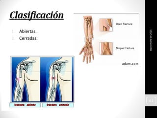 Clasificación
1. Abiertas.
2. Cerradas.
septiembrede2015
61
 