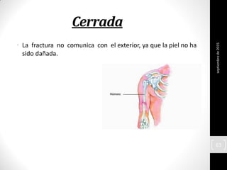 Cerrada
• La fractura no comunica con el exterior, ya que la piel no ha
sido dañada.
septiembrede2015
63
 