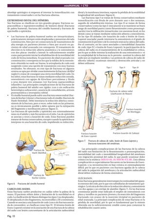 miniMANUAL 1 CTO
Pág. 10
abordaje quirúrgico si empeora al intentar la inmovilización con
tratamiento conservador o en las fracturas abiertas.
EXTREMIDAD DISTAL DEL HÚMERO.
Sus fracturas se clasifican en tres grandes grupos: fracturas su-
pracondíleas o supraintercondíleas de húmero distal (fracturas
de paleta humeral), fracturas del cóndilo humeral y fracturas de
epicóndilo o epitróclea.
• Las fracturas de paleta humeral suelen ser intraarticulares,
prácticamente siempre están desplazadas y presentan elevada
conminución, bien por ser consecuencia de traumatismos de
alta energía en pacientes jóvenes o bien por ocurrir en pa-
cientes de edad avanzada con osteopenia. El tratamiento de
elección es la reducción abierta anatómica y la osteosíntesis
con dos placas (medial y lateral) lo suficientemente estable
como para permitir iniciar la rehabilitación de la movilidad del
codo de forma inmediata. En pacientes de edad avanzada con
conminución y osteopenia en los que la solidez de la osteosín-
tesis obtenida no suele ser buena, la artroplastia de codo está
surgiendo como una opción de tratamiento con muy buenos
resultados. No obstante, en este tipo de fracturas en algunos
centros se opta por olvidar conscientemente la fractura (skillful
neglect) y tratar de conseguir una cierta movilidad del codo. En
los niños, estas fracturas se tratan mediante reducción cerrada,
osteosíntesis con agujas de Kirschner percutáneas y férula
o yeso durante tres semanas (ver fracturas supracondíleas
infantiles). Las principales complicaciones de las fracturas de
paleta humeral del adulto son rigidez (con o sin osificación
heterotópica subyacente), ausencia de consolidación, artrosis
postraumática y neuropatía cubital.
• El cóndilo humeral puede sufrir una fractura osteocondral (frac-
tura de Kocher-Lörenz) o fracturarse todo el cóndilo (fractura de
Hanh-Steinthal). Debe intentarse la reducción abierta y osteo-
síntesis de la fractura, pero a veces, sobre todo en las primeras,
no es técnicamente posible y debe optarse por la extirpación
del fragmento y movilización precoz (figura 5).
• Las fracturas de epicóndilo y epitróclea son extremadamente
raras en el adulto y más frecuentes en el niño. Las de epitróclea
se asocian a veces a luxación de codo. Estas fracturas pueden
tratarse de forma conservadora, excepto cuando la epitróclea se
interpone en una luxación de codo, impidiendo su reducción.
Figura 6. Fracturas del cóndilo humeral.
CABEZA DEL RADIO.
Estas fracturas suelen producirse en caídas sobre la palma de la
mano. El paciente refiere dolor y limitación de la movilidad en el
codo.LaclasificacióndeMasondistinguelostiposI(nodesplazada),
II (desplazada en dos fragmentos, reconstruíble) y III (conminuta).
Cuandoseasocianaunaluxacióndecodo(conosinfracturaasocia-
da de coronoides), se clasifican como tipo IV. El término lesión de
Essex-Lopresti consiste en la asociación de una fractura de la cabeza
del radio con lesión concomitante de la articulación radiocubital
distal y la membrana interósea; supone la pérdida de la estabilidad
longitudinal del antebrazo (figura 6).
Las fracturas tipo I se tratan de forma conservadora mediante
inmovilización con férula de yeso durante una o dos semanas,
seguida de rehabilitación intensa. Las tipo II se tratan de forma
conservadora (como las tipo I) únicamente si se mantiene un buen
rango de movilidad pasiva (tanto flexoextensión como pronosupi-
nación) tras la infiltración intraarticular con anestesia local; en los
demás casos se tratan mediante reducción abierta y osteosíntesis.
En las tipo III aisladas (sin luxación de codo o lesión de Essex-
Lopresti asociada) puede intentarse la osteosíntesis si el grado de
conminuciónlopermiteodelocontrarioresecarlacabezadelradio.
Por el contrario, en los casos asociados a inestabilidad (luxación
de codo [tipo IV] o lesión de Essex-Lopresti), la participación de la
cabeza del radio en el mantenimiento de la estabilidad es crítica,
por lo que se debe intentar la realización de una osteosíntesis o –si
la complejidad de la fractura no lo permite- sustituir la cabeza del
radio por un implante metálico. Las prótesis de cabeza de radio de
silicona (silastic) ocasionan sinovitis y destrucción articular y no
deben utilizarse.
Figura 7. Fractura de cabeza de radio, lesión de Essex-Lopresti y
fracturas-luxaciones del antebrazo.
Las principales complicaciones de las fracturas de la cabeza
del radio son limitación de la flexoextensión o pronosupinación,
inestabilidad del codo e inestabilidad longitudinal del antebrazo
con migración proximal del radio, lo que puede ocasionar dolor
crónico en la muñeca (MIR 03-04, 18; MIR 96-97F, 88). Esta última
complicación es especialmente frecuente en las lesiones de Essex-
Lopresti, y su reconstrucción en fase crónica es extremadamente
difícil, por lo que en pacientes con fracturas agudas de la cabeza
del radio la palpación del antebrazo y la articulación radiocubital
distal deben realizarse de forma sistemática.
OLÉCRANON.
Estasfracturasgeneralmenteinterrumpenlacontinuidaddelapara-
to extensor del codo, por lo que son subsidiarias de tratamiento qui-
rúrgico. La técnica de elección es la reducción abierta y osteosíntesis
con dos agujas y un cerclaje de alambre (figura 7). En las fracturas
conminutas puede estar indicado el empleo de osteosíntesis con
placa y tornillos en pacientes jóvenes y la resección del fragmento
fracturado con avance de la inserción tricipital en pacientes de
edad avanzada. La principal complicación de estas fracturas es la
pérdida de movilidad, por lo que es fundamental que la síntesis
obtenida sea lo suficientemente estable como para comenzar la
rehabilitación cuanto antes.
 