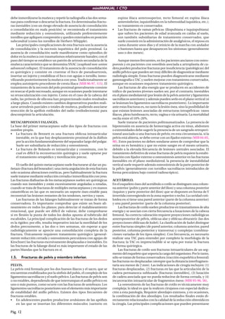 miniMANUAL 1 CTO
Pág. 12
debe inmovilizarse la muñeca y repetir la radiografía a las dos sema-
nas para confirmar o descartar la fractura. En determinadas fractu-
ras inestables (con un riesgo elevado de ausencia de consolidación
o consolidación en mala posición) se recomienda el tratamiento
mediante reducción y osteosíntesis, utilizando preferentemente
tornillos que apliquen compresión y queden enterrados en posición
subcondral (como los tornillos de Herbert-Whipple).
Las principales complicaciones de esta fractura son la ausencia
de consolidación y la necrosis isquémica del polo proximal. La
ausencia de consolidación suele manifestarse como episodios de
dolor en la muñeca con traumatismos relativamente banales; con el
paso del tiempo se establece un patrón de artrosis secundaria de la
muñeca característico que se denomina SNAC (scaphoid non-union
advanced collapse). El tratamiento de la ausencia de consolidación
es quirúrgico y consiste en cruentar el foco de pseudoartrosis,
insertar un injerto y estabilizar el foco con agujas o tornillo, inmo-
vilizando posteriormente la muñeca con yeso.Tradicionalmente se
emplea autoinjerto procedente de cresta iliaca (MIR 96-97, 115). El
tratamiento de la necrosis del polo proximal generalmente consiste
en resecar el polo necrosado, aunque en ocasiones puede intentarse
su revascularización con injerto. Como en el caso de la cabeza del
radio, las prótesis de silicona han proporcionado malos resultados
a largo plazo. Cuando existen cambios degenerativos pueden reali-
zarse artrodesis parciales o totales de muñeca, pudiendo asociarse
resección de la apófisis estiloides del radio (estilodectomía) para
descomprimir la articulación.
METACARPIANOSY FALANGES.
La base del primer metacarpiano sufre dos tipos de fracturas con
nombre propio.
• La fractura de Bennett es una fractura oblicua intraarticular
inestable, en la que hay desplazamiento proximal de la diáfisis
por la acción fundamentalmente del separador largo del pulgar.
Suele ser subsidiaria de reducción y osteosíntesis.
• La fractura de Rolando es intraarticular y conminuta, con lo
cual es difícil la reconstrucción quirúrgica y suele optarse por
el tratamiento ortopédico y movilización precoz.
El cuello del quinto metacarpiano suele fracturarse al dar un pu-
ñetazo(fracturadelboxeador);unaciertaangulacióndeestafractura
solo ocasiona alteraciones estéticas, pero habitualmente la fractura
sueletratarsemediantereduccióncerradaeinmovilizaciónconyeso.
Las fracturas diafisarias de los metacarpianos suelen ser quirúrgicas
cuando son inestables y están excesivamente anguladas o rotadas,
cuando se trata de fracturas de múltiples metacarpianos y en manos
catastróficas en las que es necesario un soporte óseo estable para
reconstruir las lesiones restantes de los tendones, nervios y vasos.
Las fracturas de las falanges habitualmente se tratan de forma
conservadora. Es importante comprobar que existe un buen ali-
neamiento en todos los planos; para detectar el malalineamiento
rotacional, que puede ser difícil de valorar, debe comprobarse
si en flexión la punta de todos los dedos apunta al tubérculo del
escafoides. La principal complicación de las fracturas de los dedos
es la rigidez; por ello, resulta imperativo iniciar la movilidad de los
dedos precozmente, a las dos o tres semanas, sin esperar a que
radiológicamente se aprecie una consolidación completa de la
fractura. Únicamente requieren tratamiento quirúrgico (general-
mente reducción cerrada y osteosíntesis percutánea con agujas de
Kirschner) las fracturas excesivamente desplazadas e inestables. En
las fracturas de la falange distal es más importante el estado de las
partes blandas que la fractura en sí.
1.5. Fracturas de pelvis y miembro inferior.
PELVIS.
La pelvis está formada por los dos huesos ilíacos y el sacro, que se
encuentran estabilizados por la sínfisis del pubis, el complejo de los
ligamentos sacroilíacos y el suelo pélvico. Las fracturas de pelvis son
o no estables, dependiendo de que interrumpan el anillo pélvico en
uno o más puntos, como ocurre con las fracturas de antebrazo. Los
ligamentossacroilíacosposterioressonelelementomásimportante
de estabilidad del anillo pélvico. Existen dos tipos frecuentes de
fracturas estables.
• En adolescentes pueden producirse avulsiones de las apófisis
en las que se insertan los diferentes músculos (sartorio en
espina ilíaca anterosuperior, recto femoral en espina ilíaca
anteroinferior, isquiotibiales en la tuberosidad isquiática, etc.);
su tratamiento es conservador.
• Las fracturas de ramas pélvicas (iliopubiana e isquiopubiana)
que sufren los pacientes de edad avanzada en caídas al suelo,
son también subsidiarias de tratamiento conservador, que
suele consistir en la administración de analgésicos, el reposo en
cama durante unos días y el reinicio de la marcha con andador
o bastones hasta que desaparecen los síntomas (generalmente
uno o dos meses).
Aunque menos frecuentes, en los pacientes ancianos con osteo-
porosis y en pacientes con osteólisis asociada a artroplastia de ca-
dera pueden producirse fracturas por insuficiencia (patológicas) del
anillopélvicoquepuedensermuydifícilesdediagnosticarmediante
radiología simple. Estas fracturas pueden diagnosticarse mediante
gammagrafía oTAC y suelen mejorar con tratamiento conservador,
aunque en ocasiones requieren tratamiento quirúrgico.
Las fracturas de alta energía que se producen en accidentes de
tráfico de pacientes jóvenes suelen ser, por el contrario, inestables
enelplanomediolateral(porlesióndelapelvisanterioryligamentos
sacroilíacosanteriores)yademáspuedenserloenelplanovertical(si
se lesionan los ligamentos sacroilíacos posteriores). Lo importante
ante estas fracturas es, no tanto la lesión ósea, sino la posibilidad de
que existan lesiones asociadas de estructuras intrapélvicas: vasos
ilíacos, plexo lumbosacro, recto, vagina o vía urinaria. La mortalidad
oscila entre el 10%-20%.
Suele tratarse de pacientes politraumatizados. La presencia de
hipotensión en ausencia de hemorragia activa en tórax, abdomen
o extremidades debe sugerir la presencia de un sangrado retroperi-
toneal asociado a una fractura de pelvis; en esta circunstancia, si la
pelvis está abierta, se debe cerrar con un fijador externo (MIR 04-05,
90). Estos pacientes no deben sondarse antes de comprobar que la
orina no es hemática y que no existe sangre en el meato urinario,
debido a la elevada frecuencia de lesiones uretrales asociadas. El
tratamiento definitivo de estas fracturas de pelvis requiere la estabi-
lización con fijador externo u osteosíntesis anterior en las fracturas
inestables en el plano mediolateral; la presencia de inestabilidad
vertical suele requerir además osteosíntesis de la parte posterior de
la pélvis (generalmente con tornillos sacroilíacos introducidos de
forma percutánea bajo control radioscópico).
ACETÁBULO.
En el esqueleto óseo del acetábulo o cotilo se distinguen una colum-
na anterior (pubis y parte anterior del ilion) y una columna posterior
(isquion y parte posterior del ilion) que se disponen en forma de Y
invertida convergiendo en la zona superior o techo. La cavidad coti-
loidea en sí tiene una pared anterior (parte de la columna anterior)
y una pared posterior (parte de la columna posterior).
Lasfracturasdecotilosuelenproducirseentraumatismosdealta
energía y se asocian con cierta frecuencia a luxaciones de la cabeza
femoral. Su correcta valoración requiere proyecciones radiológicas
anteroposterior de pélvis, oblícua alar y oblícua obturatriz (las dos
proyecciones oblícuas de Judet). La clasificación de Judet distingue
entre fracturas simples (de pared anterior, columna anterior, pared
posterior, columna posterior y transversa) y complejas (combina-
ciones variadas de los tipos simples). Con frecuencia, es necesario
realizar una TAC para entender por completo la morfología de la
fractura; la TAC es imprescindible si se opta por tratar la fractura
de forma quirúrgica.
Las fracturas de cotilo son fracturas intraarticulares de un seg-
mentodelesqueletoquesoportalacargadelorganismo.Porlotanto,
sólo se tratan de forma conservadora (tracción esquelética femoral)
lasfracturasnodesplazadas(siemprequeladistanciainterfragmen-
taria sea menor de 2 mm). Las indicaciones de cirugía incluyen: (1)
fracturas desplazadas, (2) fracturas en las que la articulación de la
cadera permanezca subluxada [fracturas inestables], (3) luxación
de cadera asociada que no pueda reducirse de forma cerrada, y (4)
incarceración intraarticular de fragmentos óseos (MIR 95-96, 56).
La osteosíntesis de las fracturas de cotilo es técnicamente muy
compleja; lo ideal es que la realicen cirujanos con especial dedica-
ción a esta patología. Requiere abordajes extensos, y en ocasiones,
la combinación de dos abordajes. Los resultados finales están di-
rectamente relacionados con la calidad de la reducción obtenida en
la cirugía. Las principales complicaciones que pueden presentarse
 