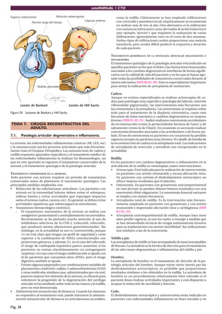 miniMANUAL 1 CTO
Pág. 38
Figura 34. Lesiones de Bankart y Hill-Sachs.
TEMA 7. CIRUGÍA RECONSTRUCTIVA DEL
ADULTO.
7.1. Patología articular degenerativa e inflamatoria.
La artrosis, las enfermedades inflamatorias crónicas (AR, LES, etc)
y la osteonecrosis son los procesos articulares que más frecuente-
mente trata el Cirujano Ortopédico. Las osteonecrosis de cadera y
rodilla requieren apartados específicos y el tratamiento médico de
las enfermedades inflamatorias lo realizan los Reumatólogos, así
que en este apartado se exponen el tratamiento conservador de la
artrosis y el tratamiento quirúrgico de la patología articular.
TRATAMIENTO CONSERVADOR DE LA ARTROSIS.
Todo paciente con artrosis requiere un periodo de tratamiento
conservador antes de plantearse el tratamiento quirúrgico. Las
principales medidas empleadas son:
• Reducción de las solicitaciones articulares. Los pacientes con
artrosis en la extremidad inferior deben evitar el sobrepeso,
utilizar bastón y evitar actividades que supongan impactos
sobre el terreno (saltos, carrera, etc). En general, se deben evitar
actividades repetitivas que sobrecarguen la articulación.
• Tratamiento farmacológico sistémico.
- El tratamiento sintomático de la artrosis se realiza con
analgésicos(paracetamol)yantiinflamatoriosnoesteroideos.
Recientemente se ha prestado mucha atención al uso de
inhibidores selectivos de la COX-2 (celecoxib, rofecoxib),
que producen menos alteraciones gastrointestinales. Sin
embargo, en la actualidad su uso es controvertido, porque
(1) no está claro que tengan un perfil de seguridad y coste
superior a la combinación de AINEs convencionales con
protectores gástricos, y además (2), en el caso del rofecoxib,
el riesgo de cardiopatía isquémica parece aumentar si los
pacientes no toman simultáneamente un antiagregante
(aspirina),encuyocasoelriesgocardiovascularseigualacon
el de pacientes que consumen otros AINEs, pero el riesgo
digestivo también se iguala.
- Existen algunos preparados con combinaciones variables de
glucosamina,condroitín-sulfato,S-adenosilmetionina(SAM)
y otras moléculas similares que, administrados por vía oral,
parecen mejorar los síntomas de la artrosis; su eficacia para
enlentecer la progresión de la degeneración del cartílago
articular se ha estudiado sobre todo en las manos y la rodilla,
pero no está demostrada.
• Administración intraarticular de fármacos. Cuando los síntomas
no responden al tratamiento oral, puede intentarse la adminis-
tración intraarticular de fármacos en articulaciones accesibles,
como la rodilla. Clásicamente se han empleado infiltraciones
con corticoide y anestésico local; empíricamente se recomienda
no realizar más de tres al año. Otra alternativa es la infiltración
con sustancias lubricantes como derivados de ácido hialurónico
(por ejemplo, Synvisc®
) que requieren la realización de varias
infiltraciones (generalmente tres) en el curso de dos semanas.
Ambos tipos de infiltraciones suelen proporcionar una mejoría
transitoria, pero resulta difícil predecir la respuesta y duración
de cada paciente.
TRATAMIENTO QUIRÚRGICO DE LA PATOLOGÍA ARTICULAR DEGENERATIVA E
INFLAMATORIA.
El tratamiento quirúrgico de la patología articular está indicado en
aquellos pacientes en los que el dolor y las limitaciones funcionales
asociadas a los cambios degenerativos interfieran de forma signifi-
cativa con la calidad de vida del paciente y en los que se hayan ago-
tado todas las posibilidades de tratamiento conservador durante al
menosseismeses(MIR00-01,89).Estoesespecialmenteimportante
para sentar la indicación de artroplastia de sustitución.
Cadera.
Aunque en centros especializados se realizan artroscopias de ca-
dera para patología muy específica (patología del labrum, sinovitis
villonodular pigmentada), las intervenciones más frecuentes son
las osteotomías y la artroplastia. Las osteotomías se emplean sobre
todo para el tratamiento de la displasia sintomática, causa más
frecuente de dolor mecánico y cambios degenerativos en mujeres
jóvenes (MIR 01-02, 91). Suelen realizarse osteotomías acetabulares
de reconstrucción (como la periacetabular bernesa de Ganz) o de
salvamento (como la de Chiari). En ocasiones es necesario realizar
osteotomías femorales asociadas a las acetabulares o de forma ais-
lada. El uso de osteotomías en pacientes con coxartrosis ha perdido
vigencia excepto en pacientes muy jóvenes. El caballo de batalla de
la reconstrucción de cadera es la artroplastia total. Las indicaciones
de artroplastia de resección y artrodesis son excepcionales en la
actualidad.
Rodilla.
En los pacientes con cambios degenerativos o inflamatorios en la
articulación de la rodilla se contemplan cuatro intervenciones:
• Artroscopia. Está indicada para la realización de sinovectomías
en pacientes con artritis reumatoide y escasa afectación ósea.
En pacientes con artrosis el desbridamiento artroscópico no
ofrece mejores resultados que el placebo.
• Osteotomía. En pacientes con gonartrosis unicompartimental
en varo jóvenes se pueden obtener buenos resultados con una
osteotomía tibial valguizante. La osteotomía femoral varizante
se emplea con menos frecuencia.
• Artroplastia total de rodilla. Es la intervención más frecuen-
temente empleada en pacientes con gonartrosis y con artritis
reumatoide e importante afectación ósea y cartilaginosa (MIR
03-04, 26).
• Artroplastia unicompartimental de rodilla. Aunque hace unos
años perdió vigencia, su uso ha vuelto a resurgir a medida que
se han desarrollado técnicas de cirugía mínimamente invasiva
para su implantación con menor morbilidad. Sus indicaciones
son similares a las de la osteotomía.
Tobillo y pie.
Lasartroplastiasdetobillosehanacompañadodetasasinaceptables
de fracaso. La artrodesis es la técnica de elección para el tratamiento
de las afecciones degenerativas e inflamatorias del tobillo y pie.
Hombro.
La artroplastia de hombro es el tratamiento de elección de la pa-
tología articular del hombro. Aunque existe cierto interés por los
desbridamientos artroscópicos, es probable que proporcionen
resultados similares a los obtenidos en la rodilla. La artrodesis de
hombro es un procedimiento relativamente bien tolerado si el
paciente desea realizar actividades importantes y está dispuesto a
aceptar la reducción de movilidad y función.
Codo.
El desbridamiento artroscópico y sinovectomía están indicado en
pacientes con enfermedades inflamatorias en fases iniciales y en
 