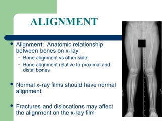 Traumatology 1.ppt -certificate in orthopaedics | PPT