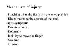 Mechanism of injury:
• Punching when the fist is in a clenched position
• Direct trauma to the dorsum of the hand
Signs/symptoms
• Pain /tenderness
• Deformity
• Inability to move the finger
• Swelling
• bruising
 