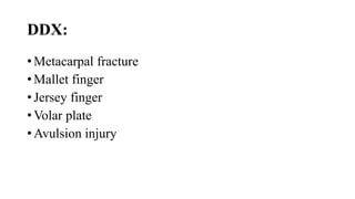 DDX:
• Metacarpal fracture
• Mallet finger
• Jersey finger
• Volar plate
• Avulsion injury
 