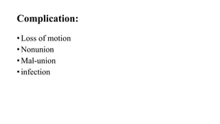 Complication:
• Loss of motion
• Nonunion
• Mal-union
• infection
 