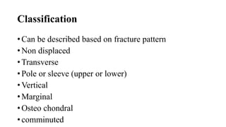 Classification
• Can be described based on fracture pattern
• Non displaced
• Transverse
• Pole or sleeve (upper or lower)
• Vertical
• Marginal
• Osteo chondral
• comminuted
 