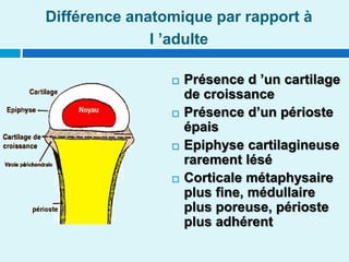 Différence anatomique par rapport à
l ’adulte
 Présence d ’un cartilage
de croissance
 Présence d’un périoste
épais
 Epiphyse cartilagineuse
rarement lésé
 Corticale métaphysaire
plus fine, médullaire
plus poreuse, périoste
plus adhérent
 
