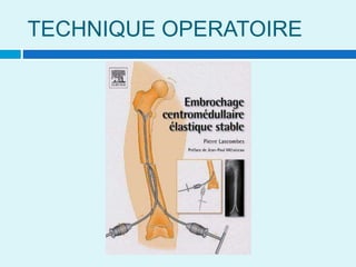 TECHNIQUE OPERATOIRE
 