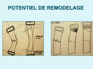 POTENTIEL DE REMODELAGE
 