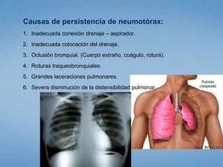 Neumotórax Abierto.Al producirse una herida en la pared torácica cuyo diámetro sea superior a 2/3 del diámetro de la traquea, el aire penetrara preferentemente por la herida al igualarse las presiones intratorácica y ambiental y ofrecer menor resistencia al paso del aire por la herida.El tratamiento inicial y precoz será cubrir la herida con un parche generoso envaselinado o plástico, de forma que tome toda la extensión de esta por tres de sus bordes, sellando la lesión y dejando una vía de escape regulable (parche sellado en tres lados.)El tratamiento definitivo consiste en la instalación de un tubo de tórax, distante de la lesión, y el cierre de la herida será quirúrgico.