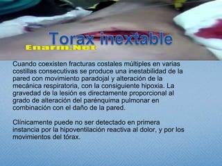 Causas de persistencia de neumotórax:Inadecuada conexión drenaje – aspirador.Inadecuada colocación del drenaje.Oclusión bronquial. (Cuerpo extraño, coágulo, rotura).Roturas traqueobronquiales.Grandes laceraciones pulmonares.Severa disminución de la distensibilidad pulmonar.    