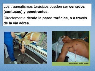 suicidios (29%), -    homicidios (22%.)