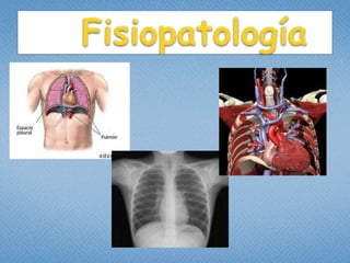        DefiniciónUn traumatismo es un hecho accidental provocado por un agente mecánico que al actuar sobre los tejidos con la suficiente fuerza e intensidad provoca   alteraciones en los mismos, con la destrucción hística parcial o total, de extensión, profundidad y gravedad variables.Un traumatismo torácico se define como el conjunto de alteraciones anatómicas y funcionales provocadas por un agente traumático sobre el tórax, produciendo una alteración, bien en sus paredes, bien en su contenido, o en ambos a la vez.