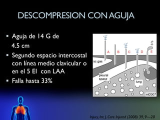 DESCOMPRESION CON AGUJA

 Aguja de 14 G de
  4.5 cm
 Segundo espacio intercostal
  con línea medio clavicular o
  en el 5 EI con LAA
 Falla hasta 33%




                                 Injury, Int. J. Care Injured (2008) 39, 9—20
 