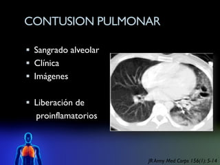CONTUSION PULMONAR

 Sangrado alveolar
 Clínica
 Imágenes


 Liberación de
  proinflamatorios



                      JR Army Med Corps 156(1): 5-14
 