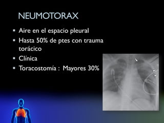 NEUMOTORAX
 Aire en el espacio pleural
 Hasta 50% de ptes con trauma
  torácico
 Clínica
 Toracostomía : Mayores 30%
 
