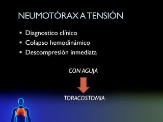NEUMOTÓRAX A TENSIÓN
 Diagnostico clínico
 Colapso hemodinámico
 Descompresión inmediata

                 CON AGUJA



                TORACOSTOMIA
 