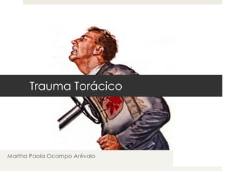 Trauma Torácico 
Martha Paola Ocampo Arévalo 
 