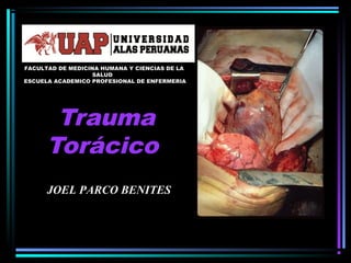 Trauma
Torácico
JOEL PARCO BENITES
FACULTAD DE MEDICINA HUMANA Y CIENCIAS DE LA
SALUD
ESCUELA ACADEMICO PROFESIONAL DE ENFERMERIA
 