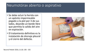 • Se debe ocluir la herida con
un apósito impermeable
pegado a la piel por 3 de sus
lados, dejando un borde libre
que permita la salida del aire
en espiración.
• El tratamiento definitivo es la
instalación de drenaje pleural
y el cierre del defecto.
Neumotórax abierto o aspirativo
Neumol Pediatr 2016; 11 (4): 185 - 192
 