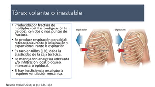 Tórax volante o inestable
• Producido por fractura de
múltiples costillas contiguas (más
de dos), con dos o más puntos de
fractura.
• Se produce respiración paradojal:
retracción durante la inspiración y
expansión durante la espiración.
• Es raro en niños (1%), dada la
elasticidad de la caja torácica.
• Se maneja con analgesia adecuada
y/o infiltración local, bloqueo
intercostal o epidural.
• Si hay insuficiencia respiratoria
requiere ventilación mecánica.
Neumol Pediatr 2016; 11 (4): 185 - 192
 