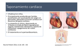 Taponamiento cardiaco
• Inhabitual en niños.
• Principalmente producido por heridas
penetrantes con acumulación de sangre en
pericardio, alterando la función cardíaca con
descenso del gasto cardíaco.
• La sospecha es clínica, observando en
1/3casos la tríada de Beck (ingurgitación
yugular, hipotensión refractaria a aporte de
volúmenes, apagamiento de ruidos
cardíacos).
• El tratamiento es la pericardiocentesis.
Neumol Pediatr 2016; 11 (4): 185 - 192
 