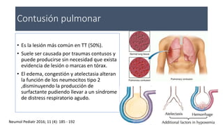 Contusión pulmonar
• Es la lesión más común en TT (50%).
• Suele ser causada por traumas contusos y
puede producirse sin necesidad que exista
evidencia de lesión o marcas en tórax.
• El edema, congestión y atelectasia alteran
la función de los neumocitos tipo 2
,disminuyendo la producción de
surfactante pudiendo llevar a un síndrome
de distress respiratorio agudo.
Neumol Pediatr 2016; 11 (4): 185 - 192
 