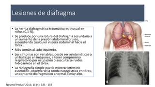 Lesiones de diafragma
• La hernia diafragmática traumática es inusual en
niños (0,1 %).
• Se produce por una rotura del diafragma secundaria a
un aumento de la presión abdominal brusco,
ascendiendo cualquier viscera abdominal hacia el
tórax .
• Más común al lado izquierdo.
• Los síntomas son variables, desde ser asintomáticas o
un hallazgo en imágenes, a tener compromiso
respiratorio por ocupación o auscultarse ruidos
hidroaéreos en el tórax.
• La radiografía simple puede mostrar intestino
ascendido ,observarse la sonda nasogástrica en tórax,
un contorno diafragmático anormal o muy alto.
Neumol Pediatr 2016; 11 (4): 185 - 192
 