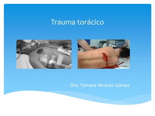 Trauma torácico
Dra. Tamara Alvarez Gómez
 