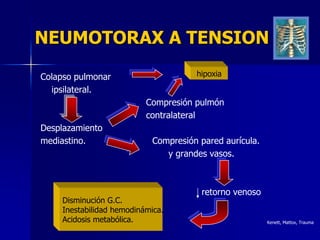 NEUMOTORAX A TENSION

Colapso pulmonar                      hipoxia

  ipsilateral.
                          Compresión pulmón
                          contralateral
Desplazamiento
mediastino.                 Compresión pared aurícula.
                               y grandes vasos.



                                       retorno venoso
    Disminución G.C.
    Inestabilidad hemodinámica.
    Acidosis metabólica.                                 Kenett, Mattox, Trauma
 