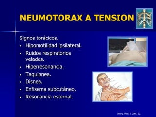 NEUMOTORAX A TENSION

Signos torácicos.
 Hipomotilidad ipsilateral.

 Ruidos respiratorios
   velados.
 Hiperresonancia.

 Taquipnea.

 Disnea.

 Enfisema subcutáneo.

 Resonancia esternal.



                               Emerg. Med. J. 2005. 22.
 