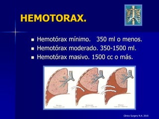 HEMOTORAX.

    Hemotórax mínimo. 350 ml o menos.
    Hemotórax moderado. 350-1500 ml.
    Hemotórax masivo. 1500 cc o más.




                                Clinics Surgery N.A. 2010
 