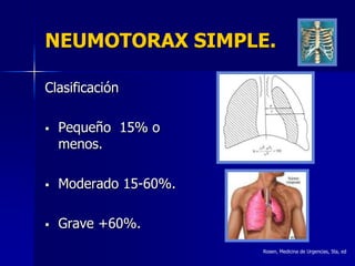 NEUMOTORAX SIMPLE.

Clasificación

   Pequeño 15% o
    menos.

   Moderado 15-60%.

   Grave +60%.
                       Rosen, Medicina de Urgencias, 5ta, ed
 