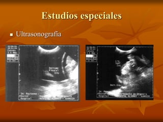 Estudios especiales
 Ultrasonografía
 
