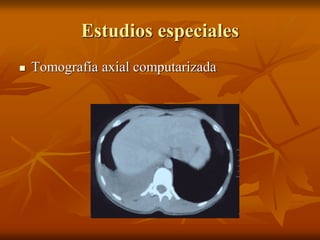 Estudios especiales
 Tomografía axial computarizada
 