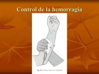 Control de la hemorragia
 