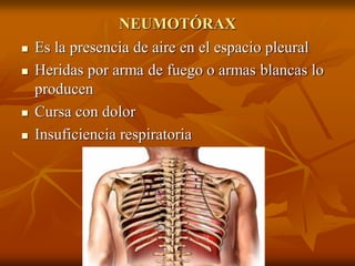 NEUMOTÓRAX
 Es la presencia de aire en el espacio pleural
 Heridas por arma de fuego o armas blancas lo
producen
 Cursa con dolor
 Insuficiencia respiratoria
 