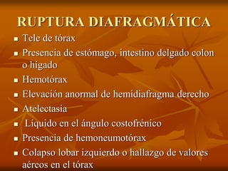 RUPTURA DIAFRAGMÁTICA
 Tele de tórax
 Presencia de estómago, intestino delgado colon
o hígado
 Hemotórax
 Elevación anormal de hemidiafragma derecho
 Atelectasia
 Líquido en el ángulo costofrénico
 Presencia de hemoneumotórax
 Colapso lobar izquierdo o hallazgo de valores
aéreos en el tórax
 