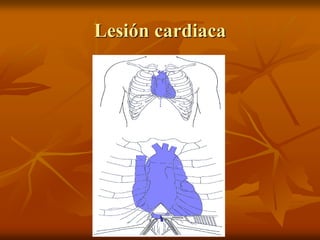 Lesión cardiaca
 