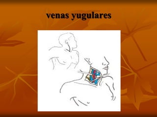 venas yugulares
 
