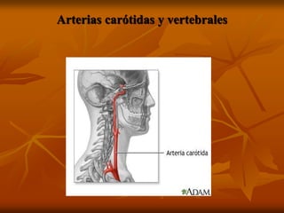 Arterias carótidas y vertebrales
 