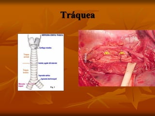 Tráquea
 