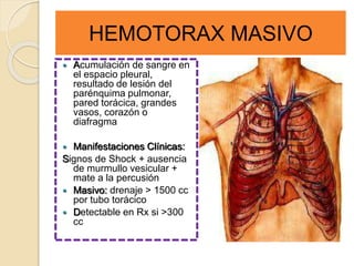 HEMOTORAX MASIVO
 Acumulación de sangre en
el espacio pleural,
resultado de lesión del
parénquima pulmonar,
pared torácica, grandes
vasos, corazón o
diafragma
 Manifestaciones Clínicas:
Signos de Shock + ausencia
de murmullo vesicular +
mate a la percusión
 Masivo: drenaje > 1500 cc
por tubo torácico
 Detectable en Rx si >300
cc
 