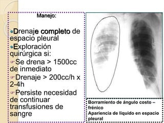 Manejo:
Drenaje completo de
espacio pleural
Exploración
quirúrgica si:
Se drena > 1500cc
de inmediato
Drenaje > 200cc/h x
2-4h
Persiste necesidad
de continuar
transfusiones de
sangre
Borramiento de ángulo costo –
frénico
Apariencia de liquido en espacio
pleural
 