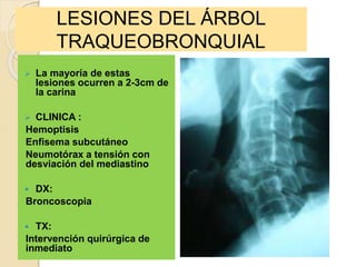 LESIONES DEL ÁRBOL
TRAQUEOBRONQUIAL
 La mayoría de estas
lesiones ocurren a 2-3cm de
la carina
 CLINICA :
Hemoptisis
Enfisema subcutáneo
Neumotórax a tensión con
desviación del mediastino
 DX:
Broncoscopia
 TX:
Intervención quirúrgica de
inmediato
 