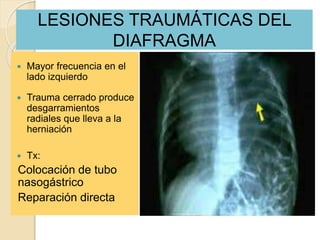 LESIONES TRAUMÁTICAS DEL
DIAFRAGMA
 Mayor frecuencia en el
lado izquierdo
 Trauma cerrado produce
desgarramientos
radiales que lleva a la
herniación
 Tx:
Colocación de tubo
nasogástrico
Reparación directa
 