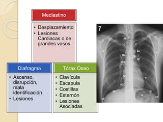 Mediastino
• Desplazamiento
• Lesiones
Cardiacas o de
grandes vasos
Diafragma
• Ascenso,
disrupción,
mala
identificación
• Lesiones
Tórax Óseo
• Clavícula
• Escapula
• Costillas
• Esternón
• Lesiones
Asociadas
 