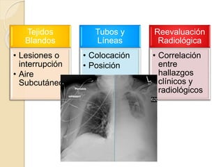 Tejidos
Blandos
• Lesiones o
interrupción
• Aire
Subcutáneo
Tubos y
Líneas
• Colocación
• Posición
Reevaluación
Radiológica
• Correlación
entre
hallazgos
clínicos y
radiológicos
 
